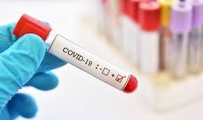 Covid Test.jpg