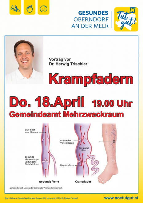 Krampfadern 20240418 web